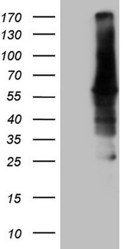 CAMK2B Mouse anti-Human, Clone: OTI8D9, lyophilized, TrueMAB 100 &mu;g;