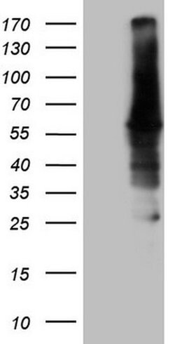 CAMK2B Monoclonal Antibody (OTI8D9), TrueMAB , OriGene 30 &mu;L | Buy Online | Origene Technologies | Fisher Scientific