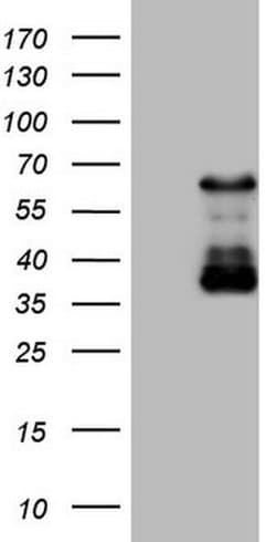 CAMK2B Monoclonal Antibody (OTI10G2), TrueMAB , OriGene:Antibodies:Primary