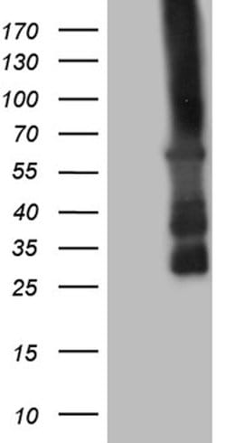 CAMK2B Mouse anti-Human, Clone: OTI4G5, lyophilized, TrueMAB 100 &mu;g;