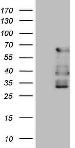 CAMK2B Monoclonal Antibody (OTI4B12), TrueMAB , OriGene 30 &mu;L; Unconjugated:Antibodies,