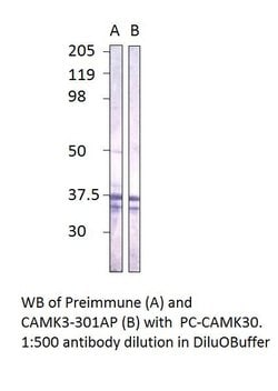 CaMKII gamma Rabbit anti-Human, Mouse, Polyclonal, FabGennix 200 &mu;L;