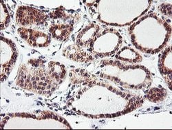 CAMLG Monoclonal Antibody (OTI1A3), TrueMAB , OriGene 100 &mu;L; Unconjugated:Antibodies,
