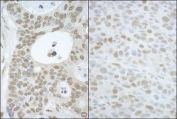 CAND1 Rabbit anti-Human, Mouse, Polyclonal, Bethyl Laboratories 100 &mu;L;