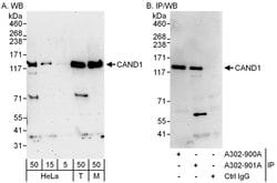 CAND1 Rabbit anti-Human, Mouse, Polyclonal, Bethyl Laboratories 100 &mu;L;