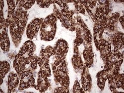 CANT1 Mouse anti-Human, Clone: OTI7F8, liquid, TrueMAB 100 &mu;L; Unconjugated:Antibodies,
