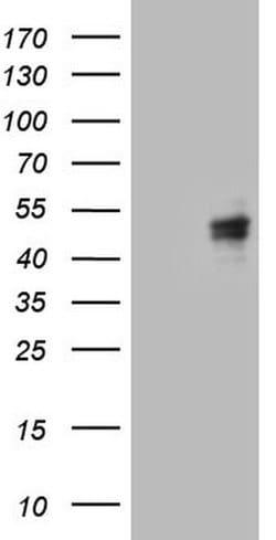 CANT1 Mouse anti-Human, Clone: OTI7F8, lyophilized, TrueMAB 100 &mu;g;
