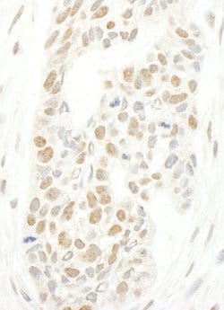 CAP-H2 Polyclonal Antibody, Bethyl Laboratories 100 &mu;L; Unconjugated:Antibodies,