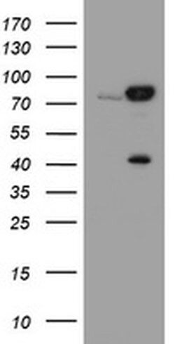 CAPN2 Mouse anti-Canine, Human, Clone: OTI3G1, liquid, TrueMAB 100 &mu;L;