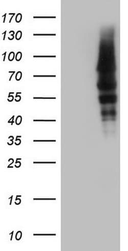 CAPN5 Monoclonal Antibody (OTI1F10), TrueMAB , OriGene:Antibodies:Primary