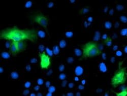 CAPN9 Monoclonal Antibody (OTI2G1), TrueMAB , OriGene 100 &mu;L; Unconjugated:Antibodies,
