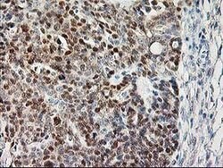 CAPN9 Monoclonal Antibody (OTI3G10), TrueMAB , OriGene 30 &mu;L; Unconjugated:Antibodies,