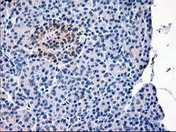 CAPN9 Monoclonal Antibody (OTI3G10), TrueMAB , OriGene:Antibodies:Primary