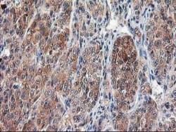 CAPN9 Monoclonal Antibody (OTI3G10), TrueMAB , OriGene 30 &mu;L; Unconjugated:Antibodies,