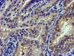 CAPN9 Monoclonal Antibody (OTI2G1), TrueMAB , OriGene 100 &mu;L; Unconjugated:Antibodies,