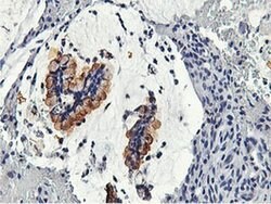 CAPN9 Monoclonal Antibody (OTI2G1), TrueMAB , OriGene 100 &mu;L; Unconjugated:Antibodies,