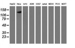 CAPN9 Monoclonal Antibody (OTI2G1), TrueMAB , OriGene 100 &mu;L; Unconjugated:Antibodies,