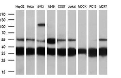 CAPZA1 Mouse anti-Human, Clone: OTI2G4, liquid, TrueMAB 100 &mu;L; Unconjugated:Antibodies,