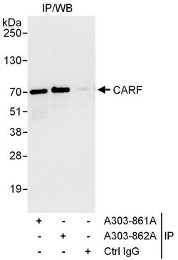 CARF Rabbit anti-Human, Mouse, Polyclonal, Bethyl Laboratories 100 &mu;L;
