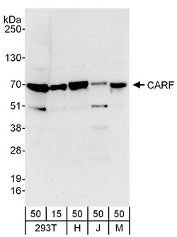 CARF Rabbit anti-Human, Mouse, Polyclonal, Bethyl Laboratories 100 &mu;L;