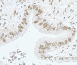 CARM1 Rabbit anti-Human, Mouse, Polyclonal, Bethyl Laboratories 100 &mu;L;