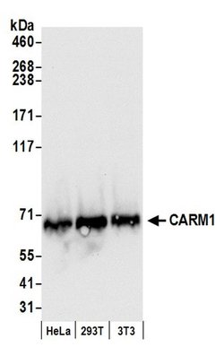 CARM1 Rabbit anti-Human, Mouse, Polyclonal, Bethyl Laboratories 100 &mu;L;