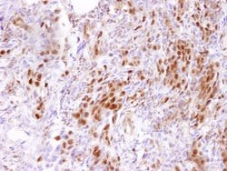 CARM1 Polyclonal Antibody, Bethyl Laboratories 100 &mu;L; Unconjugated:Antibodies,