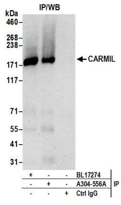 CARMIL Rabbit anti-Human, Polyclonal, Bethyl Laboratories 100 &mu;L; Unconjugated:Antibodies,