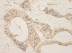 CASC3 Rabbit anti-Human, Polyclonal, Bethyl Laboratories 100 &mu;L; Unconjugated:Antibodies,