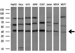 CASP4 Mouse anti-Human, Clone: OTI4A2, lyophilized, TrueMAB 100 &mu;g;