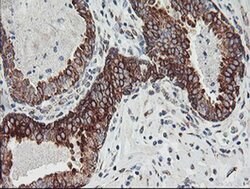 CAST Monoclonal Antibody (OTI1E7), TrueMAB , OriGene 100 &mu;L; Unconjugated:Antibodies,