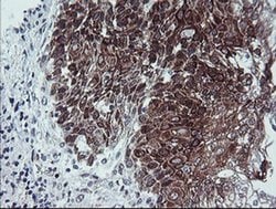 CAST Monoclonal Antibody (OTI1E7), TrueMAB , OriGene 100 &mu;L; Unconjugated:Antibodies,