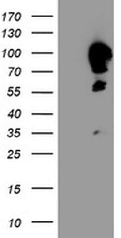 CAST Monoclonal Antibody (OTI1E7), TrueMAB , OriGene:Antibodies:Primary