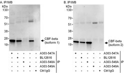 CBF-beta Rabbit anti-Human, Polyclonal, Bethyl Laboratories 10 &mu;L; Unconjugated:Antibodies,