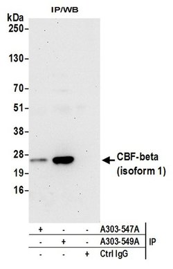 CBF-beta (isoform 1) Rabbit anti-Human, Mouse, Polyclonal, Bethyl Laboratories 100 &mu;L | Buy Online | Bethyl Laboratories, Inc | Fisher Scientific