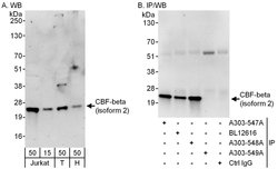 CBF-beta (isoform 2) Rabbit anti-Human, Polyclonal, Bethyl Laboratories