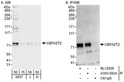 CBFA2T2 Rabbit anti-Human, Polyclonal, Bethyl Laboratories 100 &mu;l; Unlabeled:Antibodies,