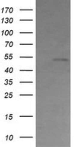 CBLC Mouse anti-Human, Clone: OTI3B4, lyophilized, TrueMAB 100 &mu;g; Unconjugated:Antibodies,