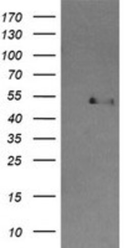 CBLC Mouse anti-Human, Clone: OTI4E3, lyophilized, TrueMAB 100 &mu;g; Unconjugated:Antibodies,
