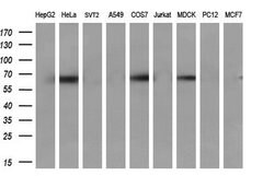 CBLC Mouse anti-Human, Clone: OTI4E3, lyophilized, TrueMAB 100 &mu;g; Unconjugated:Antibodies,
