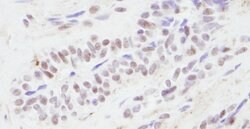 CBP Rabbit anti-Human, Polyclonal, Bethyl Laboratories 100 &mu;L; Unconjugated:Antibodies,