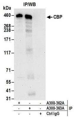 CBP Rabbit anti-Human, Polyclonal, Bethyl Laboratories 100 &mu;L; Unconjugated:Antibodies,
