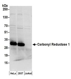 Carbonyl Reductase 1/CBR1 Polyclonal Antibody, Bethyl Laboratories:Antibodies:Primary