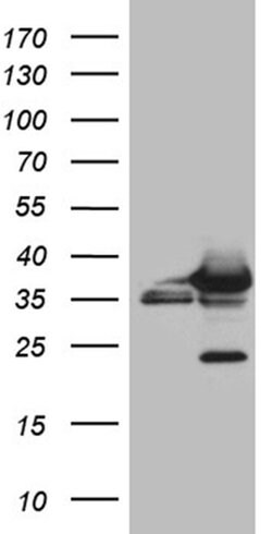 CBR1 Mouse anti-Human, Clone: OTI4B4, liquid, TrueMAB 100 &mu;L; Unconjugated:Antibodies,