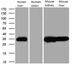 CBR1 Mouse anti-Human, Clone: OTI4B4, liquid, TrueMAB 100 &mu;L; Unconjugated:Antibodies,