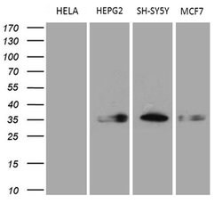 CBR1 Mouse anti-Human, Clone: OTI4B4, liquid, TrueMAB 100 &mu;L; Unconjugated:Antibodies,