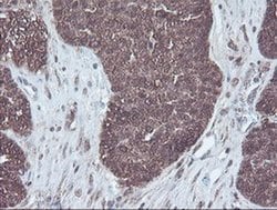 CBR3 Monoclonal Antibody (OTI1G6), TrueMAB , OriGene 100 &mu;L; Unconjugated:Antibodies,