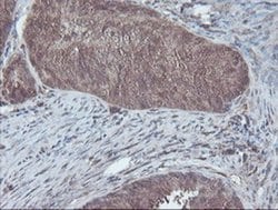 CBR3 Monoclonal Antibody (OTI1G6), TrueMAB , OriGene 100 &mu;L; Unconjugated:Antibodies,