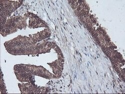 CBR3 Monoclonal Antibody (OTI1G6), TrueMAB , OriGene 100 &mu;L; Unconjugated:Antibodies,