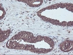 CBR3 Monoclonal Antibody (OTI1G6), TrueMAB , OriGene 100 &mu;L; Unconjugated:Antibodies,